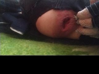 687d01772302f Prolapse ass big